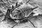 An aphid (Myzus persicae) vector of brassica viruses as seen in the scanning electron microscope